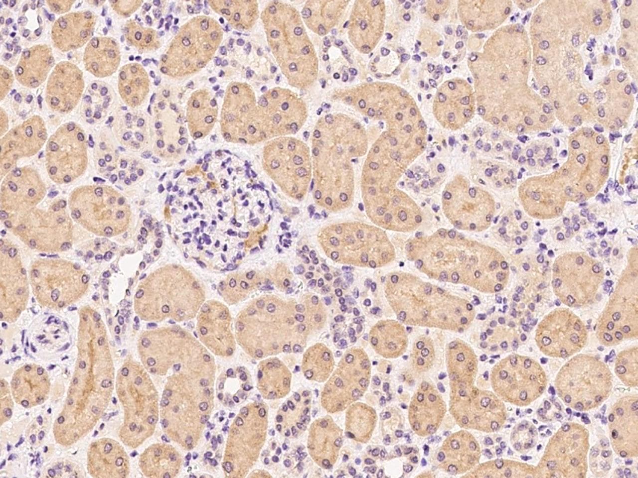 ATP6V0A2 Antibody (Preservative Free)