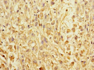 ERBB2IP / Erbin Antibody
