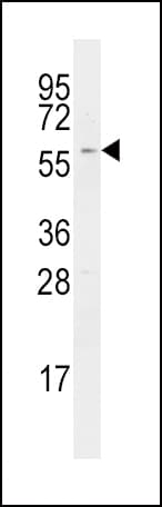 RICK / RIP2 Antibody (aa458-488)