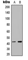 Polyclonal Rabbit anti-Human RBMX Antibody (N-Terminus, IHC, IF, WB)