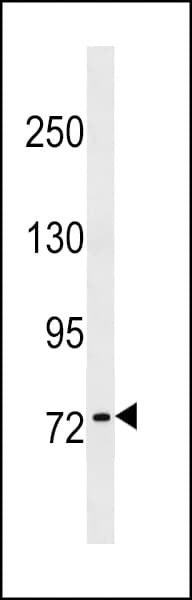 KHNYN Antibody (aa587-615)
