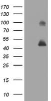 IHC-plus™ Monoclonal Mouse anti-Human MAGEA3 Antibody (clone 4E2, IHC, WB)