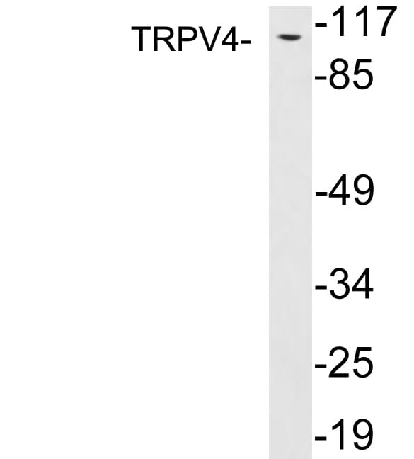 TRPV4 Antibody