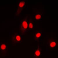 Polyclonal Rabbit anti-Human LIG4 / DNA Ligase IV Antibody (Internal, IHC, IF, WB)