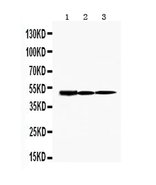 HAVCR1 / KIM-1 Antibody (aa289-307)