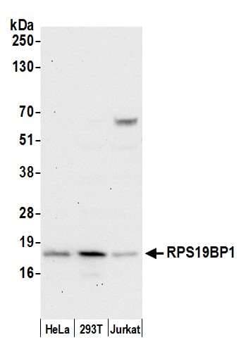 RPS19BP1 Antibody (aa86-136)