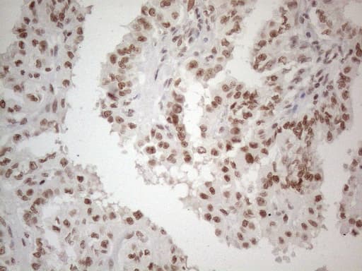 NR2C2 / TAK1 Antibody (aa1-241, clone OTI4B1)