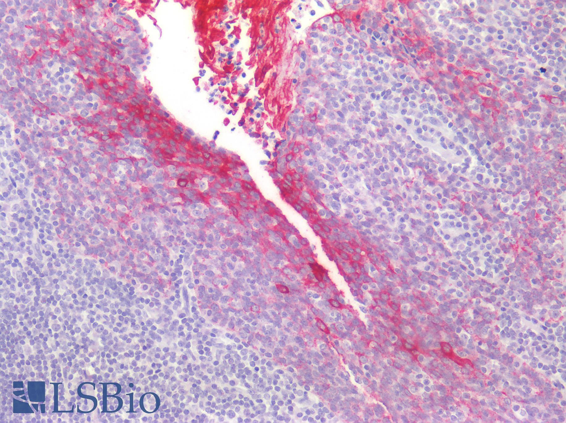 PathPlus™ KRT4 / CK4 / Cytokeratin 4 Antibody (clone 5H5)