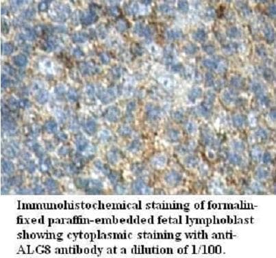 ALG8 Antibody (aa26-103)