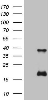 KLK3 / PSA Antibody (aa25-261, clone OTI2C9, Carrier-free)