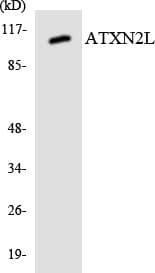 ATXN2L Antibody (aa561-610)