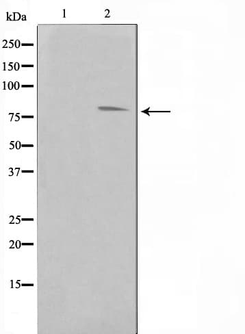 FER Antibody