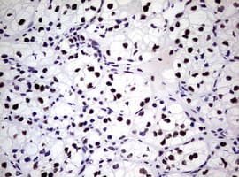 NBN / Nibrin Antibody (clone OTI6E11)