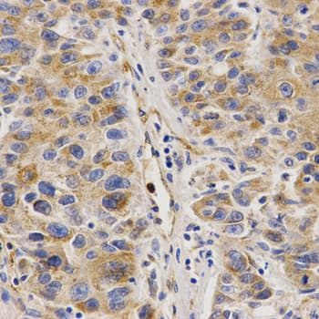 VAPB Antibody