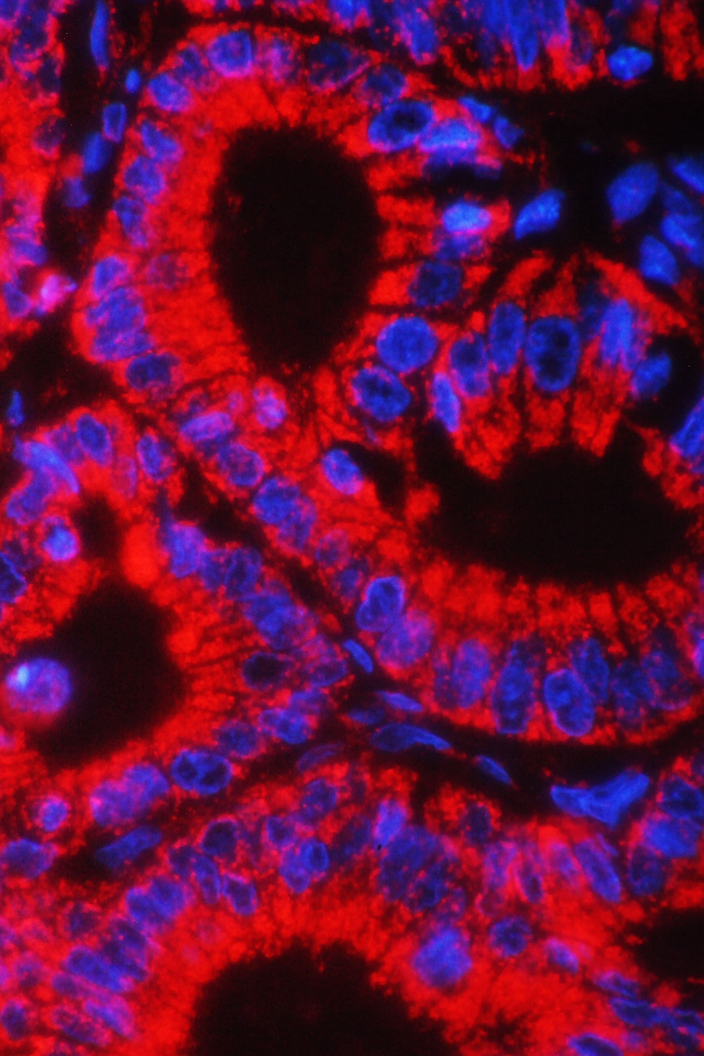 HSPE1 / HSP10 / Chaperonin 10 Antibody (aa81-102)