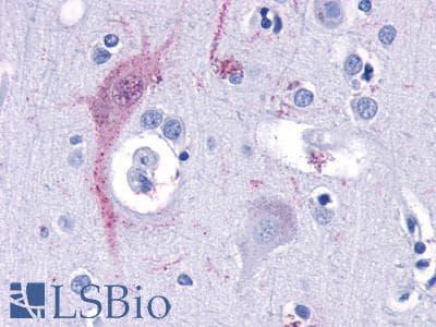 PathPlus™ TAAR9 Antibody (Extracellular Domain)