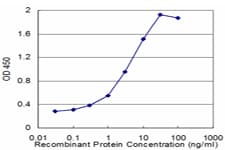 IHC-plus™ HDAC4 Antibody (clone 2B11)