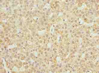 JAGN1 Antibody