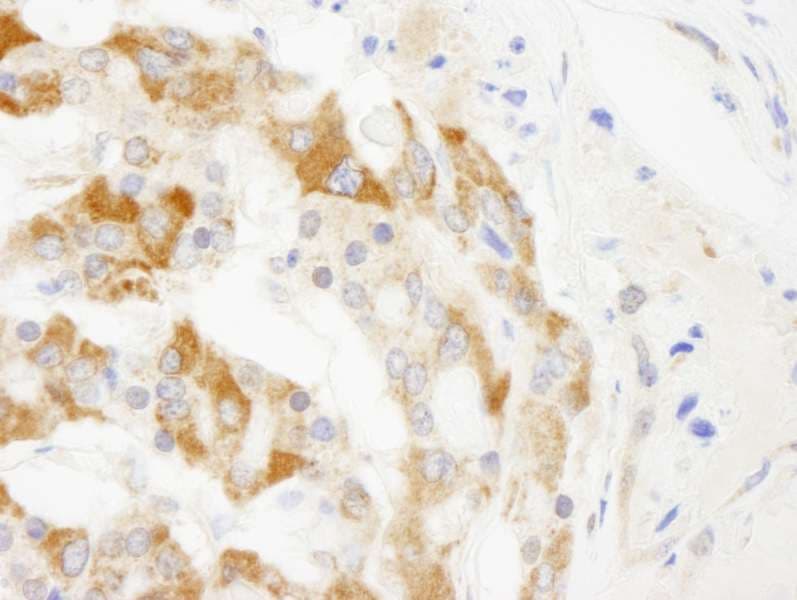 TRIM3 Antibody (aa1-50)