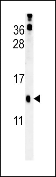 PLA2G16 / HRASLS3 Antibody (aa104-132)