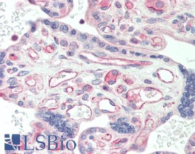 IHC-plus™ AP2A1 / AP2-Alpha Antibody (aa1-260)