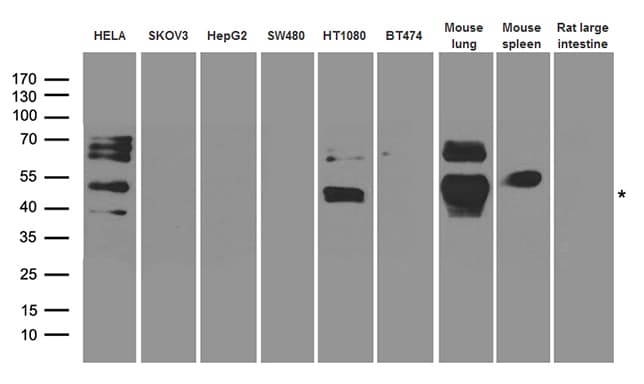 ARA55 / HIC-5 Antibody