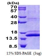 Human CMC1 Protein (Recombinant His)