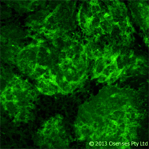 NGFR / CD271 / TNR16 Antibody (clone MC192)