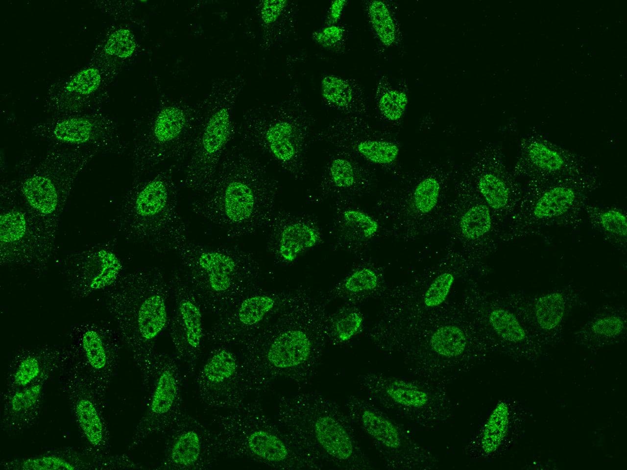 FOXR2 Antibody