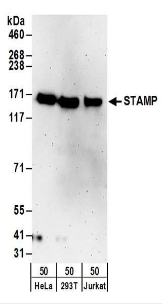 Polyclonal Rabbit anti-Human TTLL5 Antibody (aa1231-1281, WB)