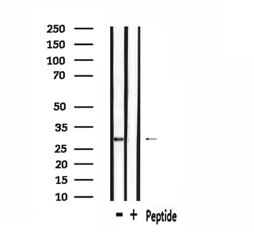 OR6C75 Antibody