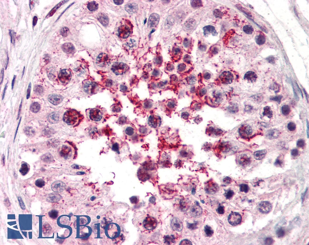 IHC-plus™ Polyclonal Rabbit anti-Human ADAM20 Antibody (Internal, IHC)
