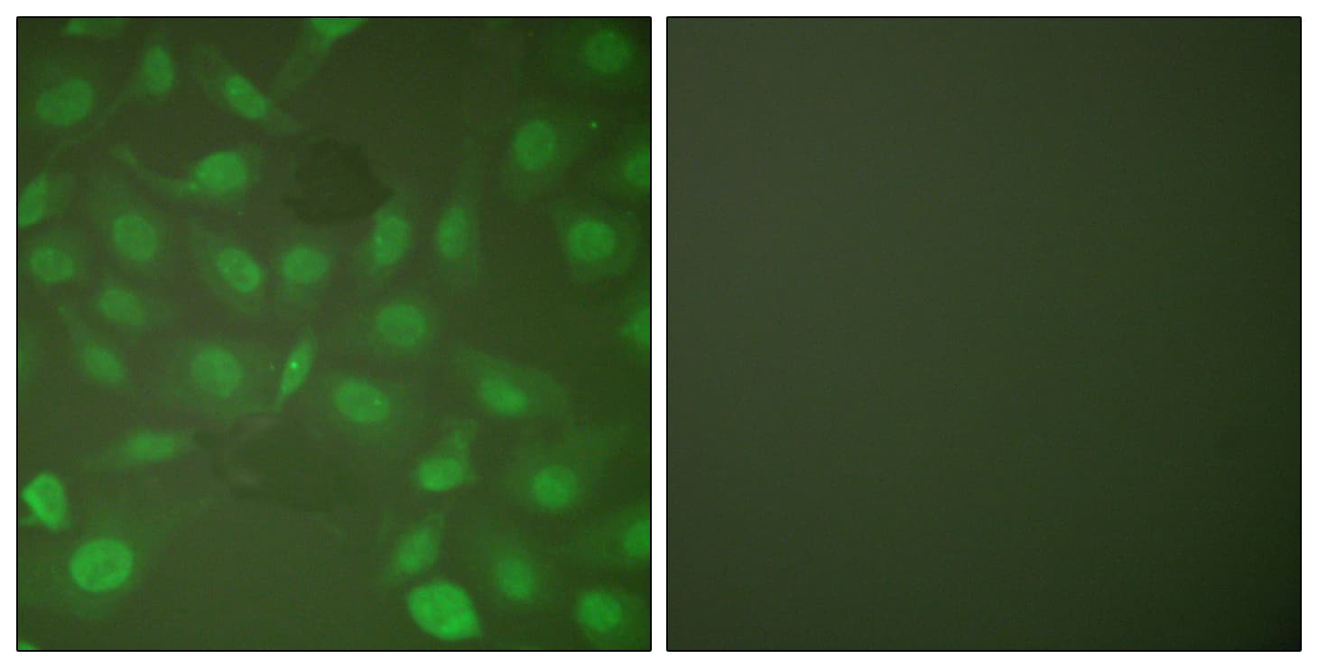 C/EBP Beta / CEBPB Antibody (phospho-Thr235/Thr188)