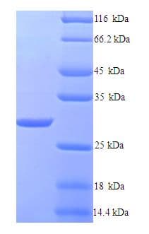 Klebsiella pneumoniae Beta Lactamase Protein (Recombinant 6His, N-terminus)