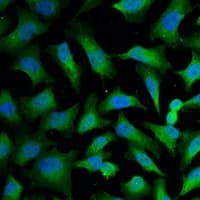 Monoclonal Mouse anti-Human KRT18 / CK18 / Cytokeratin 18 Antibody (IF, WB)