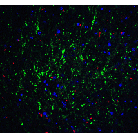 IHC-plus™ Polyclonal Rabbit anti-Human RPSA / Laminin Receptor Antibody (IHC, IF, WB)