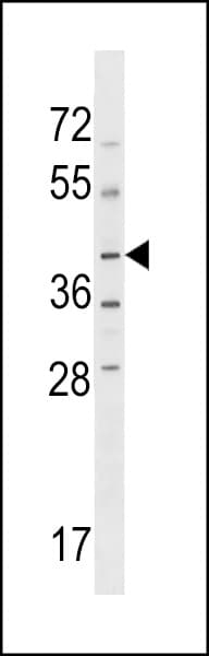 NPR2L / TUSC4 Antibody (aa346-373)