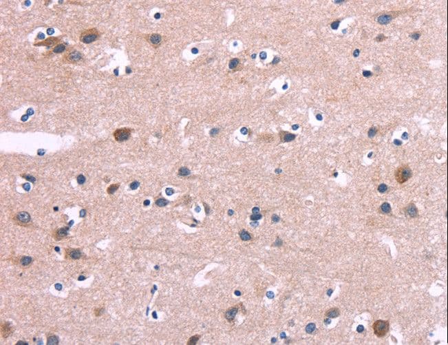 DUSP13 Antibody