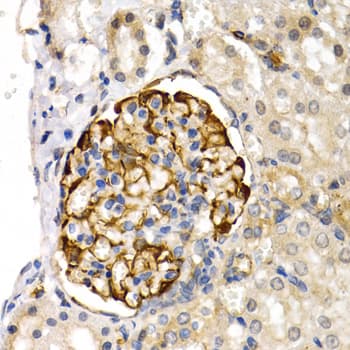 LIPG / Endothelial Lipase Antibody