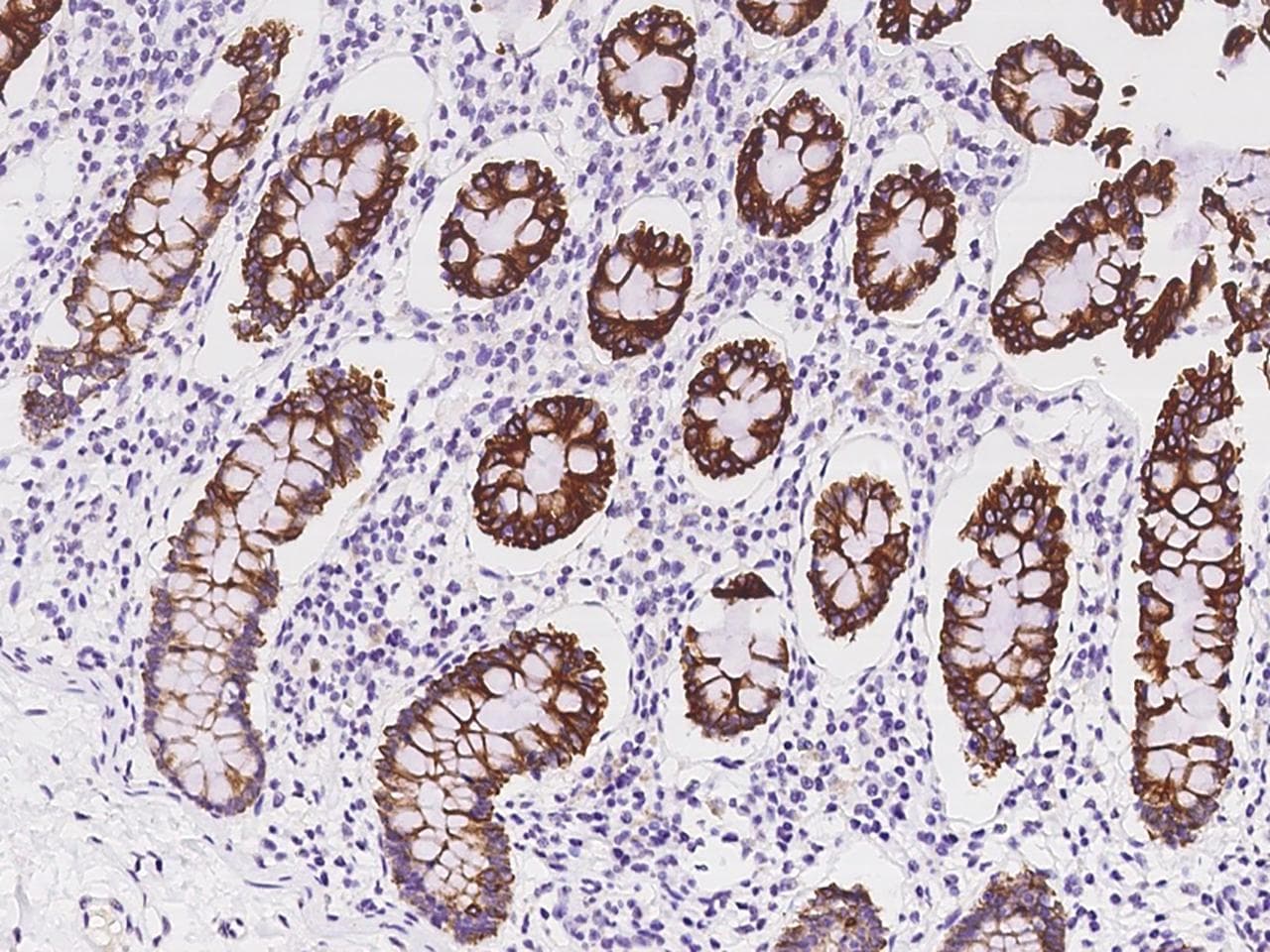 AMMECR1 Antibody