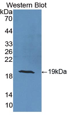 SOD1 / Cu-Zn SOD Antibody (aa2-152)