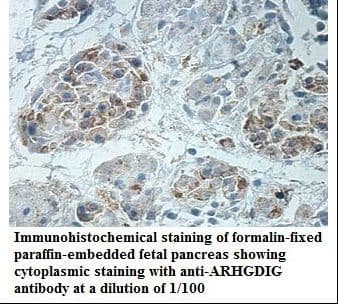 Polyclonal Rabbit anti-Human ARHGDIG / RHOGDI-3 Antibody (aa27-205, IHC, WB)