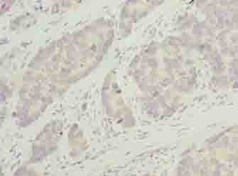 PLEKHJ1 Antibody