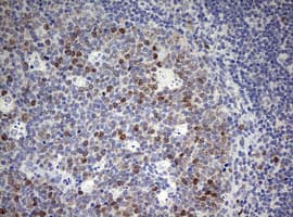 TOP2A / Topoisomerase II Alpha Antibody (aa1100-1531, clone OTI5E6, Carrier-free)