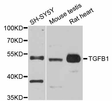 TGFB1 / TGF Beta 1 Antibody