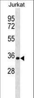 HNRPA1 / HnRNP A1 Antibody (aa266-294)