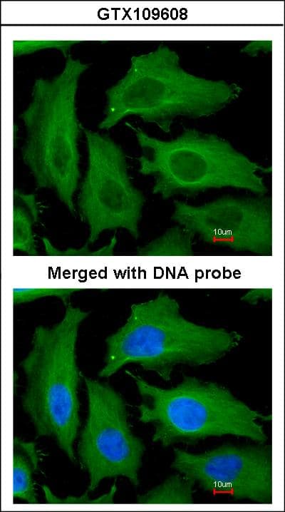IHC-plus™ DECR1 Antibody (aa1-335)