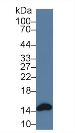 FABP3 / H-FABP Antibody (aa2-133, APC)
