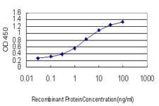 Monoclonal Mouse anti-Human LDLR / LDL Receptor Antibody (clone 5E7, WB)
