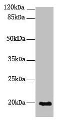 Polyclonal Rabbit anti-Human NUDT11 Antibody (IHC, WB)